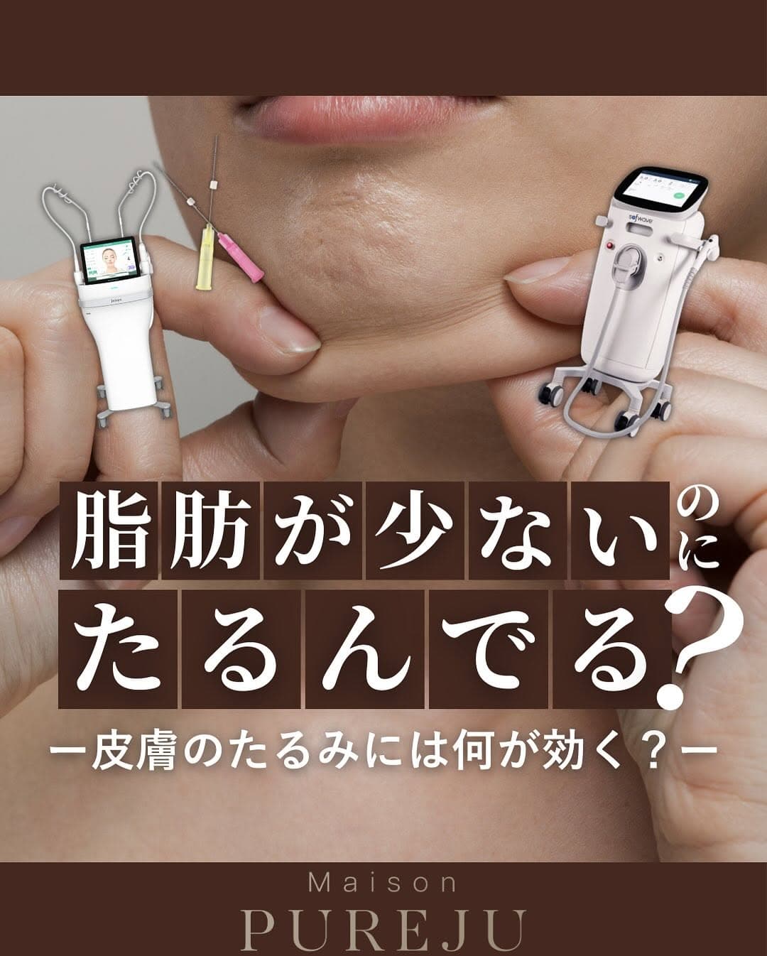皮膚たるみに特化した治療3選|ソフウェーブ・ショートスレッド・ニードルRFで真皮層から引き締め