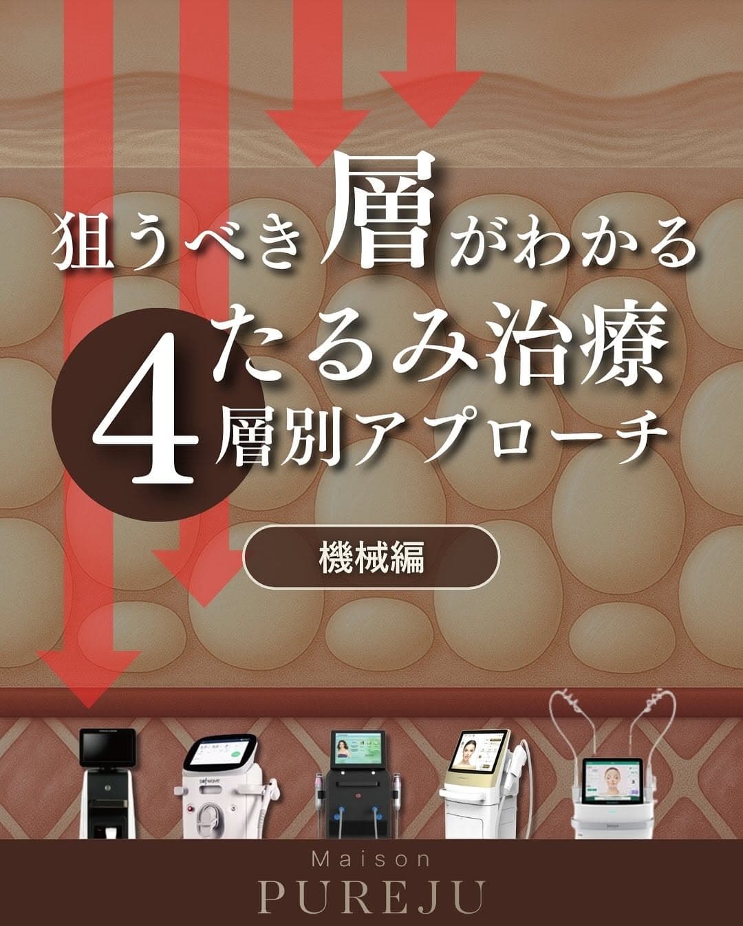 たるみ治療4層別アプローチ(機械編)|SMAS・脂肪層・真皮深層・真皮浅層ごとに最適な機器を解説