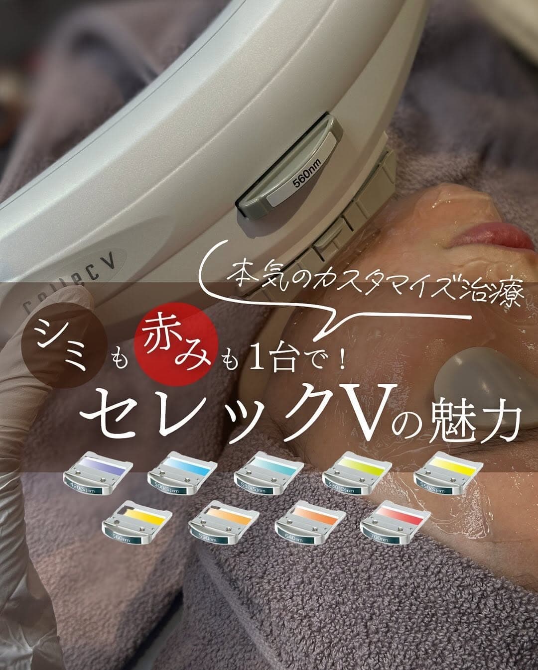 セレックVの9波長カスタマイズ治療|シミ×赤み×小じわを1台で同時改善できる理由と症例