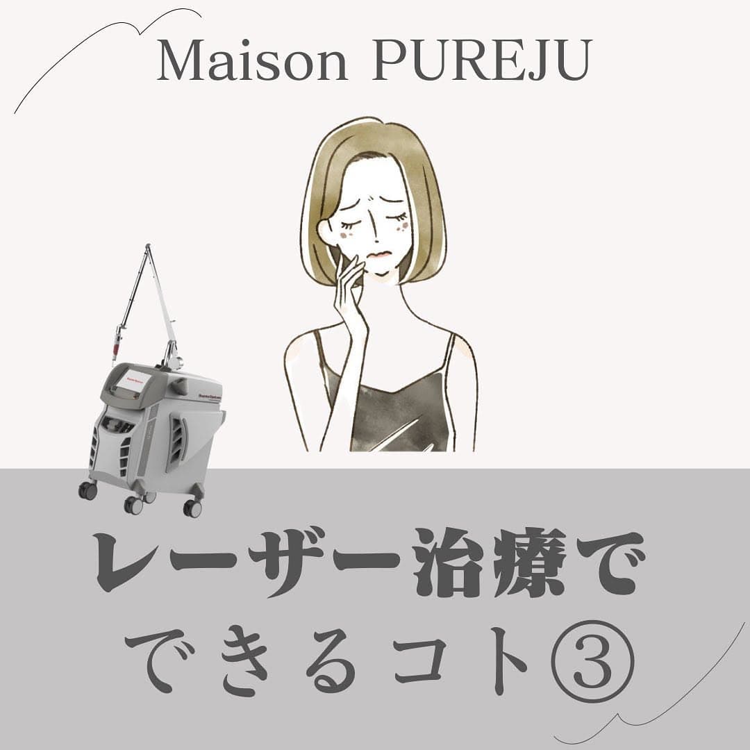 ルビーフラクショナルとは|光治療で消えないシミ・ADMをダウンタイム短めで改善