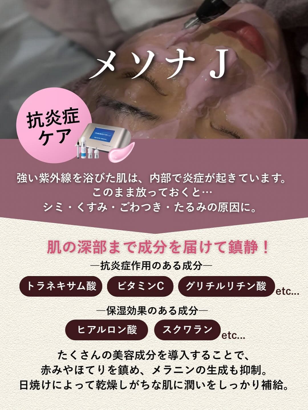 日焼け後のレスキューケア|メソナJ×高濃度ビタミンC点滴でUV-A・UV-Bダメージを内外からWアプローチ