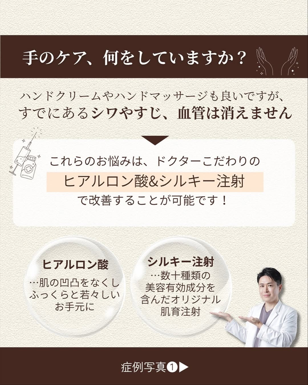 お手元の若返り術2選|ヒアルロン酸・シルキー注射で手のシワ・すじ・血管をケアする方法