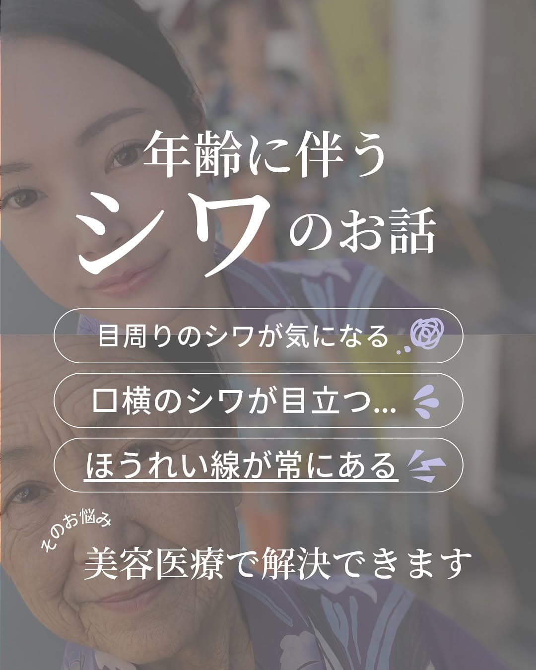 年齢に伴うシワのお話|種類を知れば最適なケアが見えてくる
