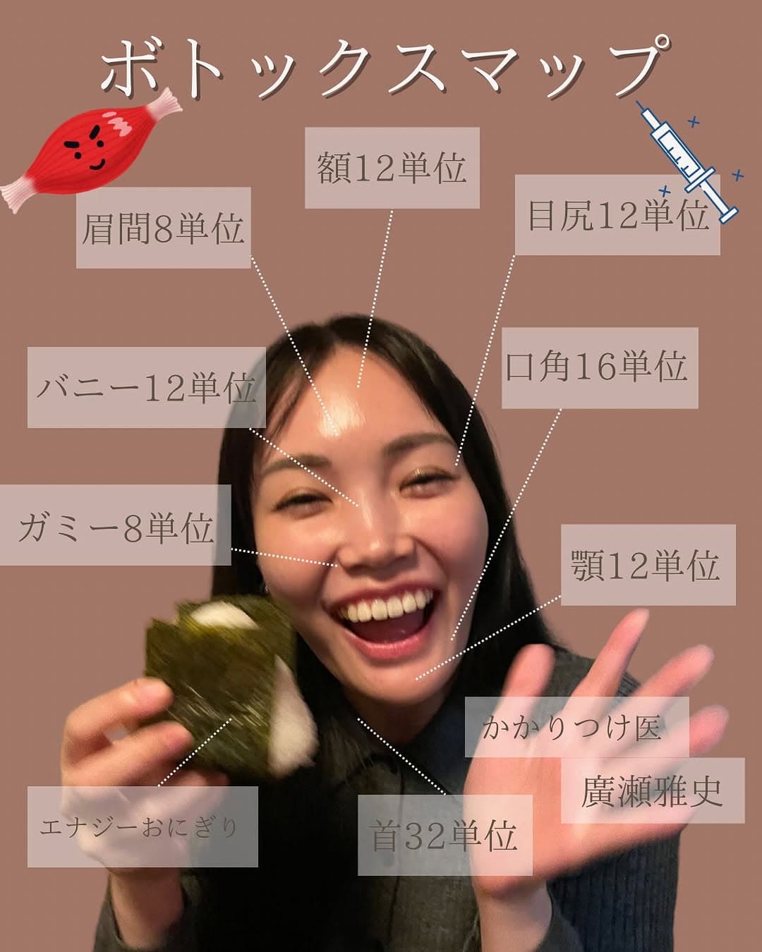 ボトックスは基本のキ!印象の良い表情をつくるための私のボトックスマップ