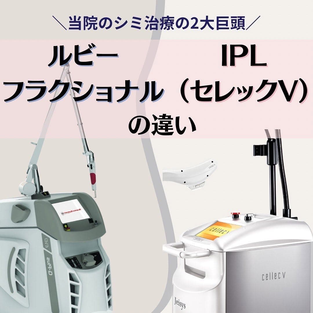 シミ治療の選び方|ルビーフラクショナルとIPL(セレックV)の違いを徹底比較