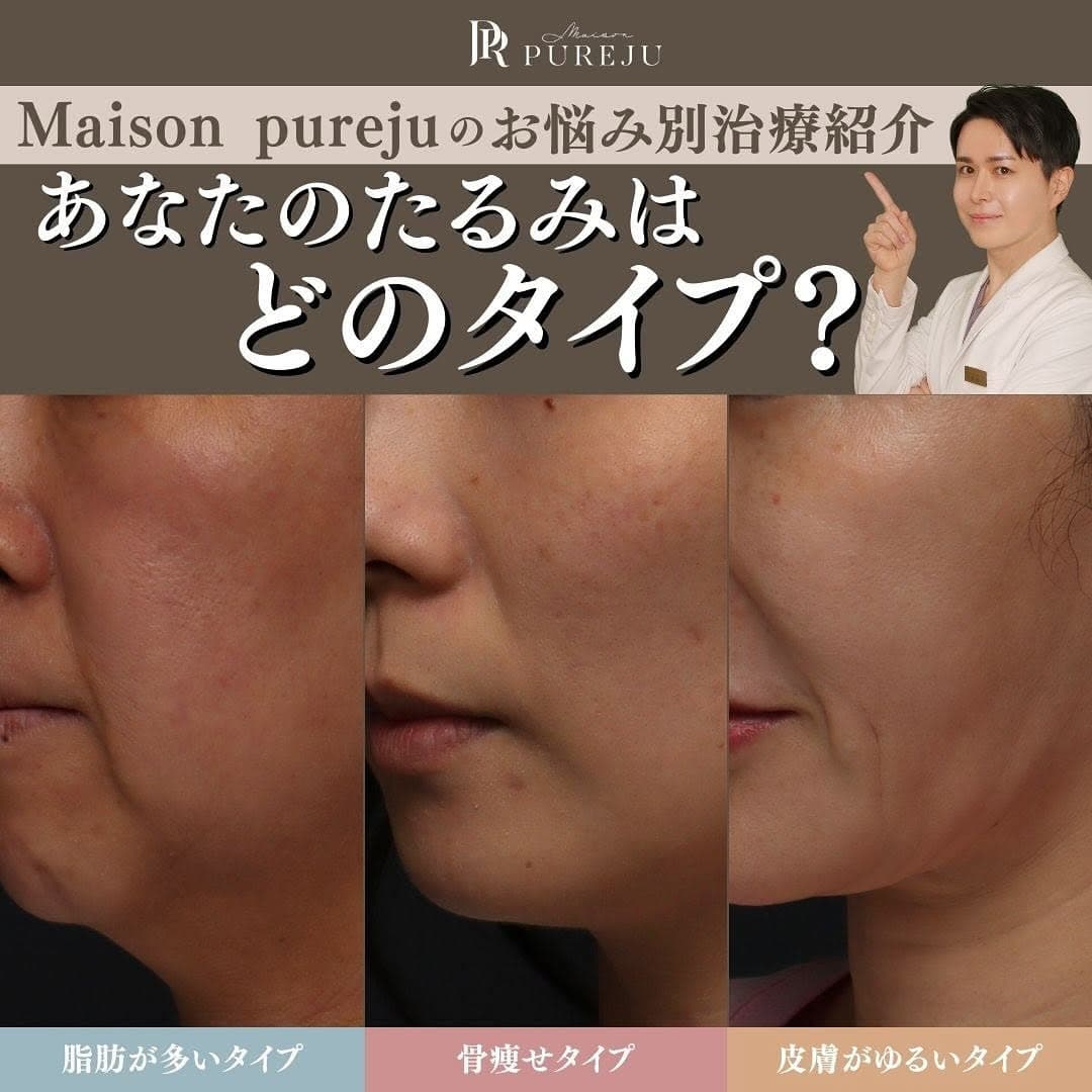 あなたのたるみはどのタイプ?原因3タイプ別おすすめ治療を医師が解説
