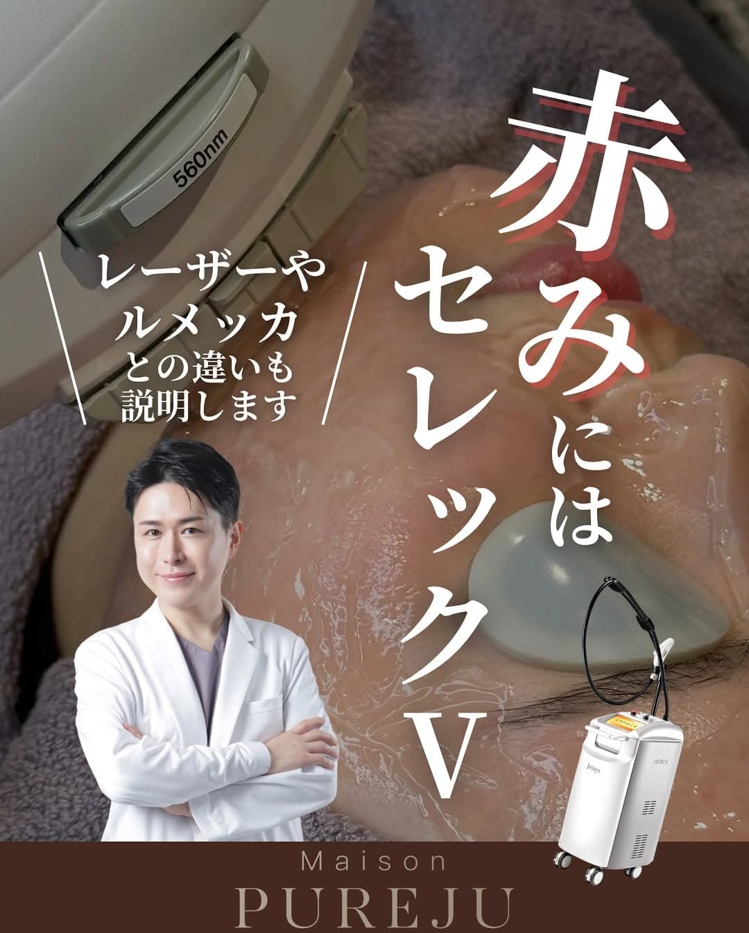 顔の赤みにはセレックV|9種類のフィルターで赤み・シミ・くすみ・毛穴をオーダーメイドで改善するIPL治療