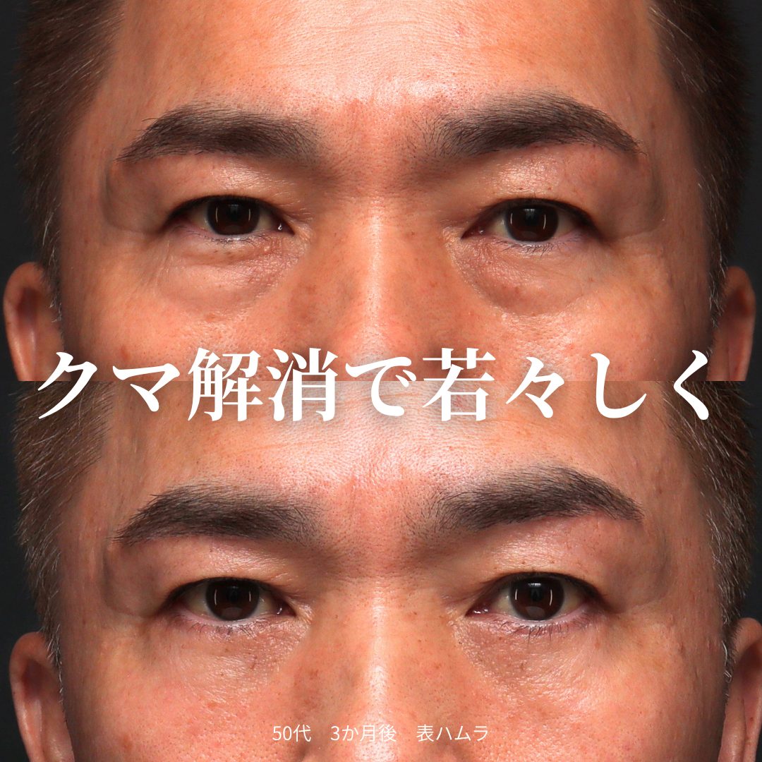 表ハムラの症例（治療前後の写真）
