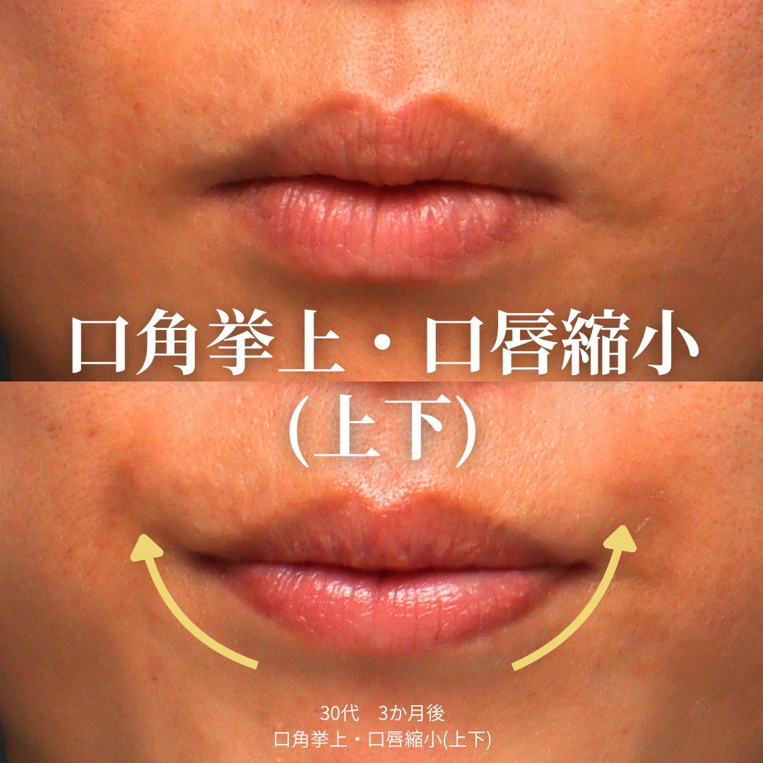 治療前（上）と治療3ヶ月後（下）