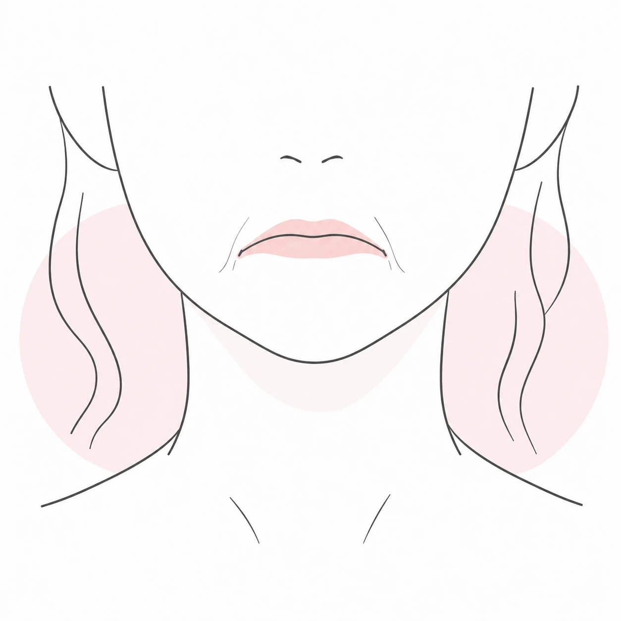たるみが関係しているタイプの口元イラスト(イメージ)